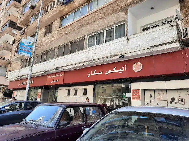 اليكس سكان