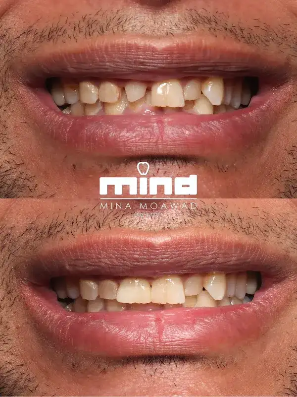 Mina Moawad Dental Clinic