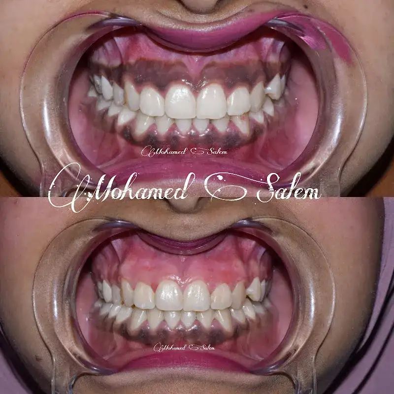 .. Dentist Mohamed Salem طبيب اسنان محمد سالم