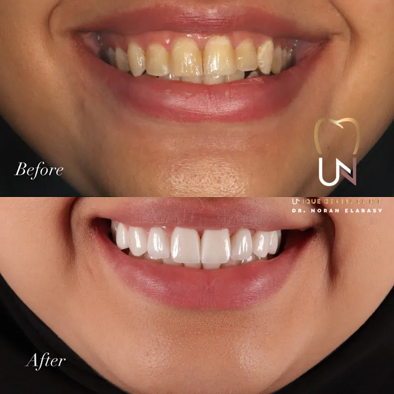 Unique Dental Clinic / Dr. Noran Elabasy / Dr. Noran Elabasy for Cosmetic and Implant Dentistry