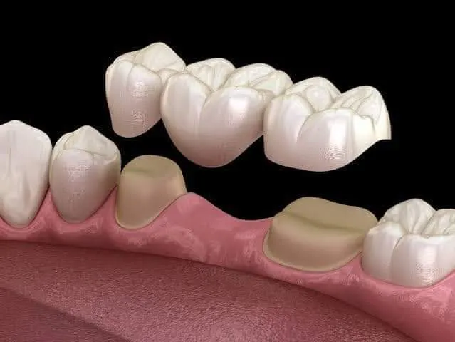 Wagdy Aziz Rezk Dental Laboratory for Dental Prosthetics