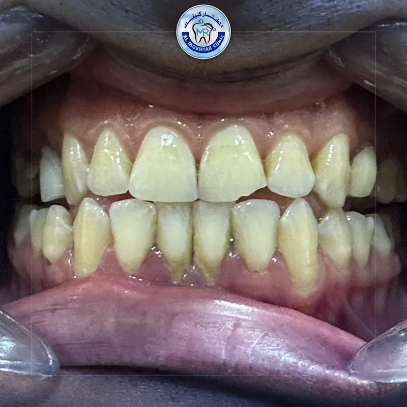 Nour Smile Clinic د جلال نورالدين
