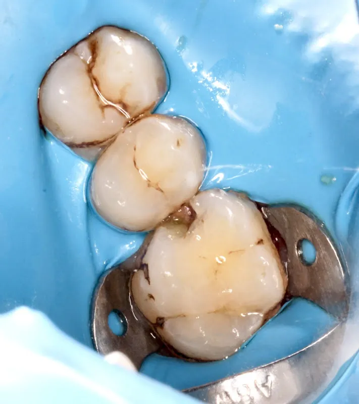 د/سيف النصر لطب الفم والاسنان Seif Dental Clinic