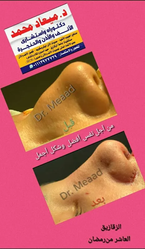 Dr. Mayad Mohammed Clinic. Ear, Nose, and Throat (ENT), and Rhinoplasty and Otoplasty.