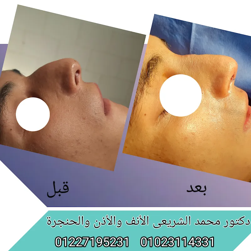 مركز التيسير لجراحات ومناظير الأنف والأذن والحنجرة