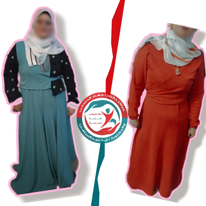 مراكز دكتور جهاد الحلوجي للتخسيس وتنسيق القوام