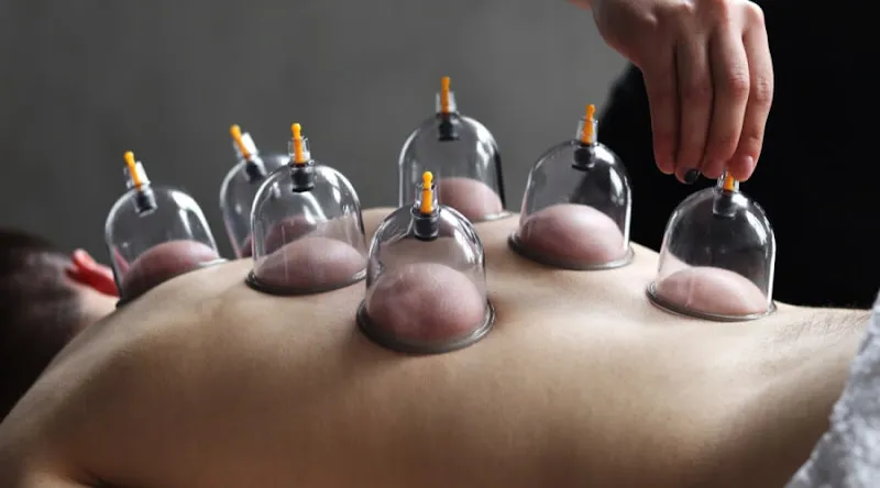 Wellness House Physiotherapy and Cupping