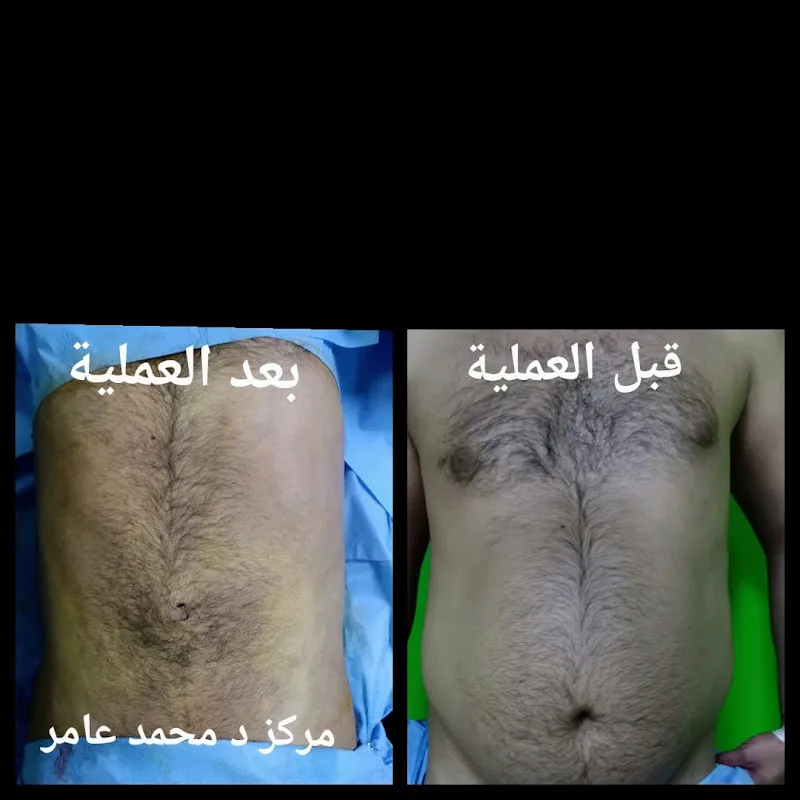 مركز د/ محمد عامر للتجميل والليزر وتنسيق القوام