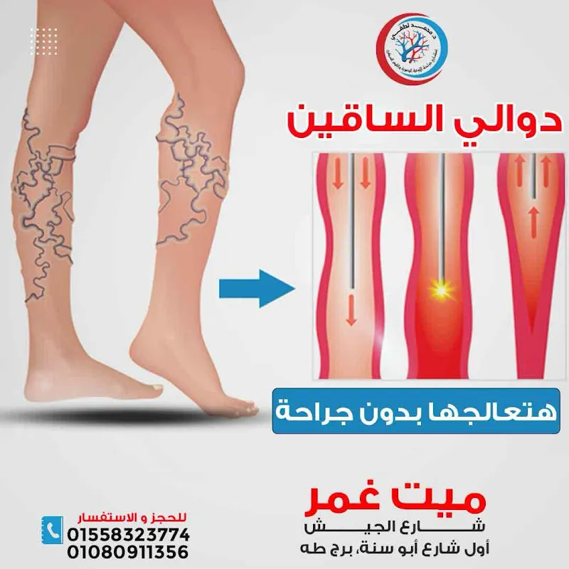 د محمد لطفي لجراحة اوعية دموية وقدم سكري