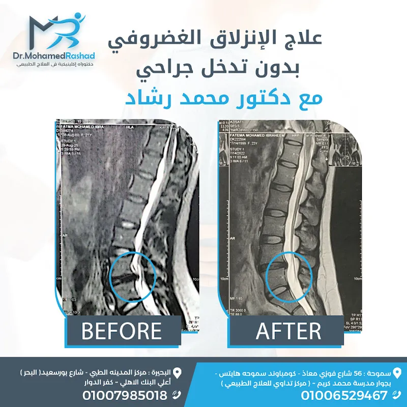 Dr. Mohamed Rashad Consultant Physiotherapist - City Medical Center - Kafr Eldawar