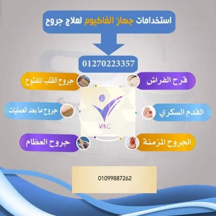 فاك دمياط لخدمات التمريض المنزلي والغيار على الجروح والقدم السكري باستخدام أحدث الاجهزه