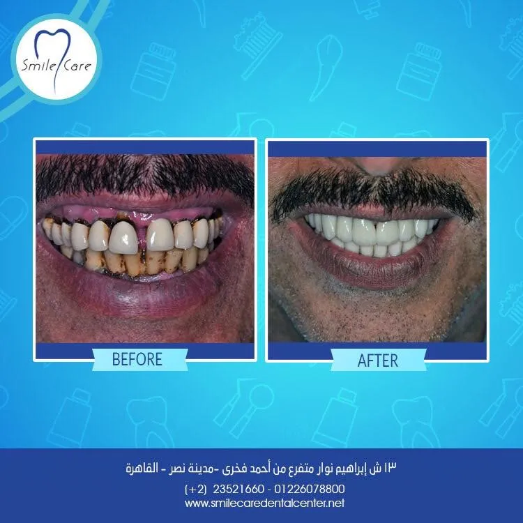 Smile Care Egypt Dental