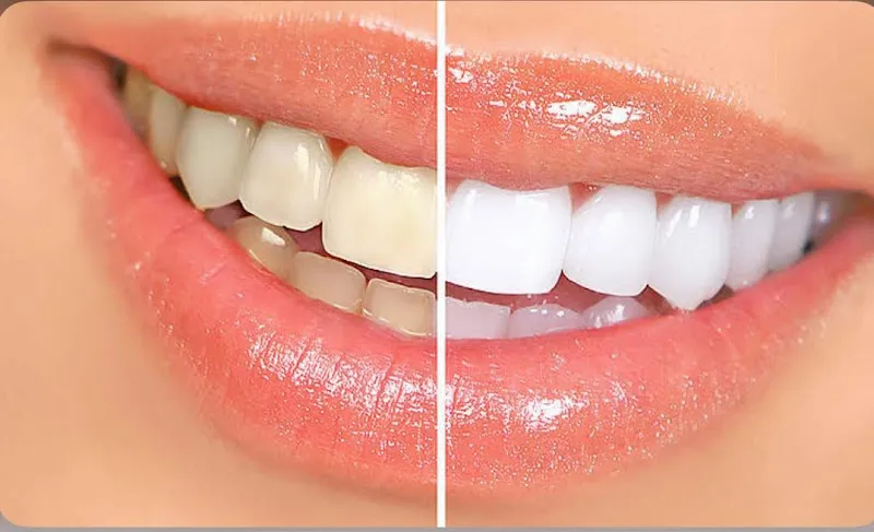 Dr. Beshoy Malak Dental Clinic