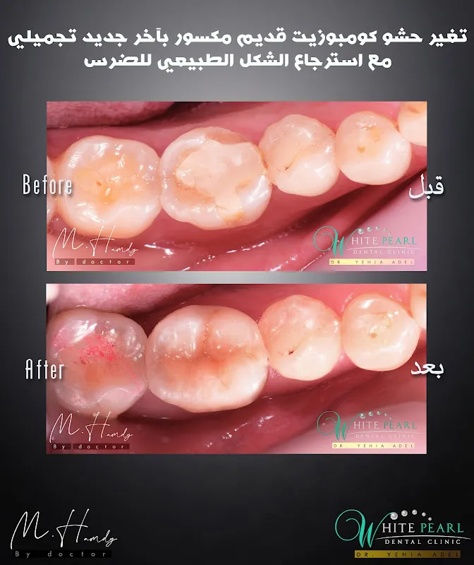 American Dental Clinic Egypt العيادة الامريكية لطب الاسنان مصر