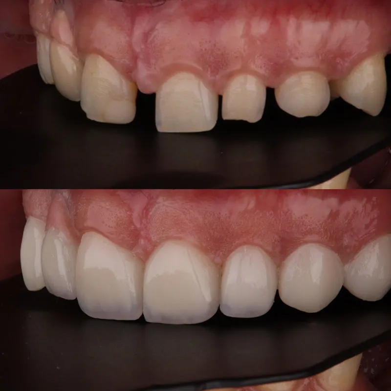Nabil Dental Clinic, Dr. Mohamed Nabil Fawzi, Specialist in Oral Surgery, Cosmetic Dentistry, and Dental Implants