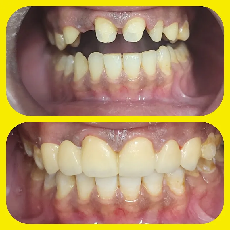 International Dental Center Miami