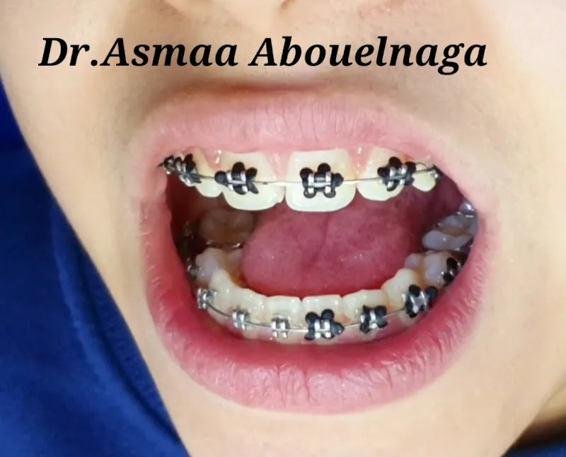 مركز الدكتوره أسماء ابوالنجا لتقويم الأسنان