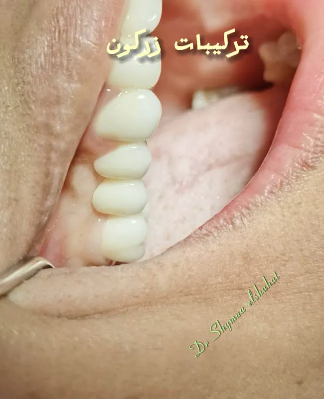 Dr. Shaimaa Al-Shahat Oral and Dental Clinic in Al-Jalaa Street - Mansoura-dr Shymaa elshahat dental clinics
