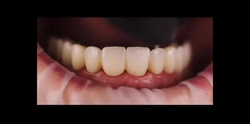Dr. Mohamed Salah Owais for Implant, Cosmetic and Orthodontics - Sadat City