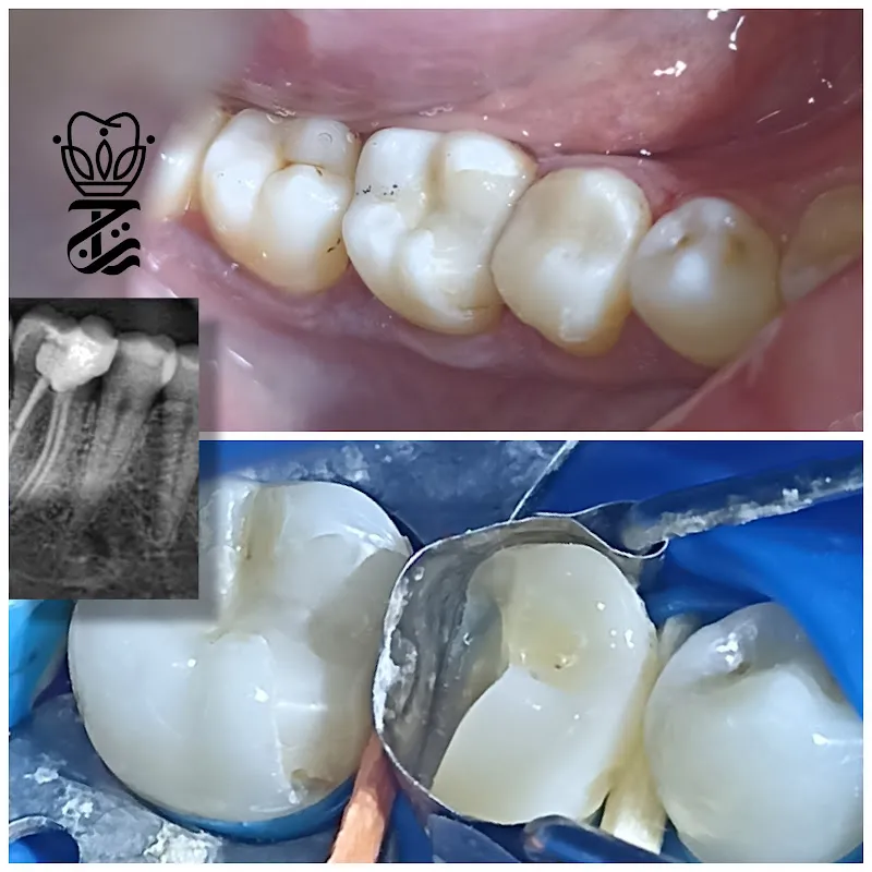 عيادات تاج لطب الاسنان