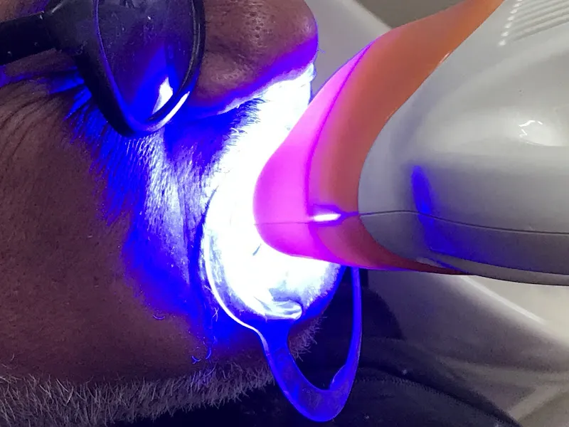 عيادة اسنان دكتور احمد شحاته بالمحلة الكبري Chehata dental Clinic