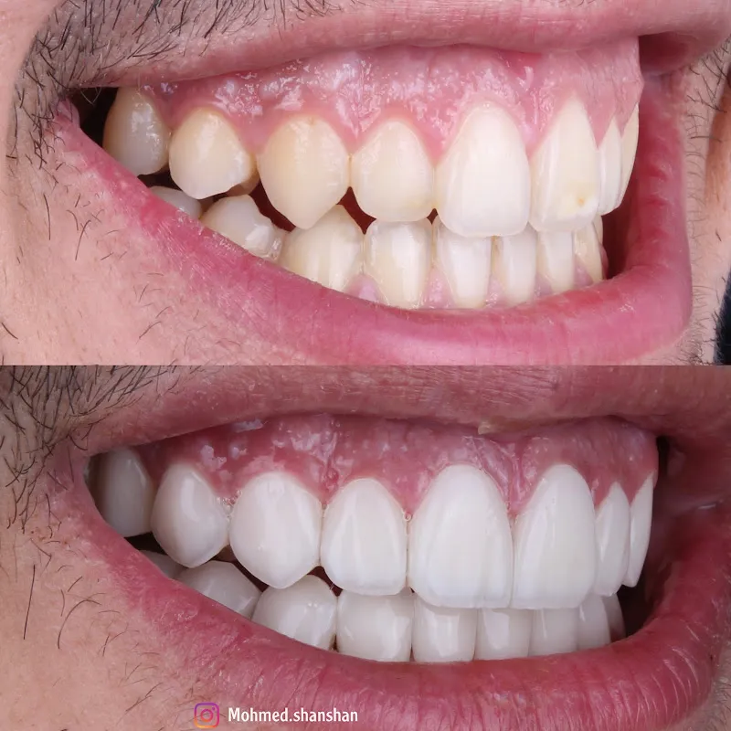 X Dental Clinics Dr. Mohamed Shanshan