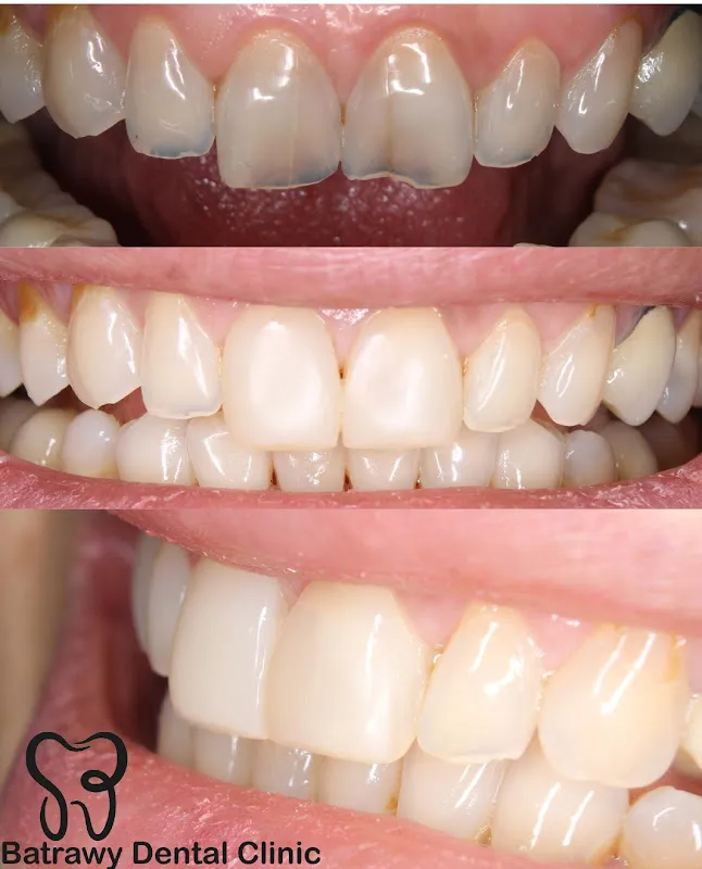 Dr Shady Elbatrawy Dental Clinic