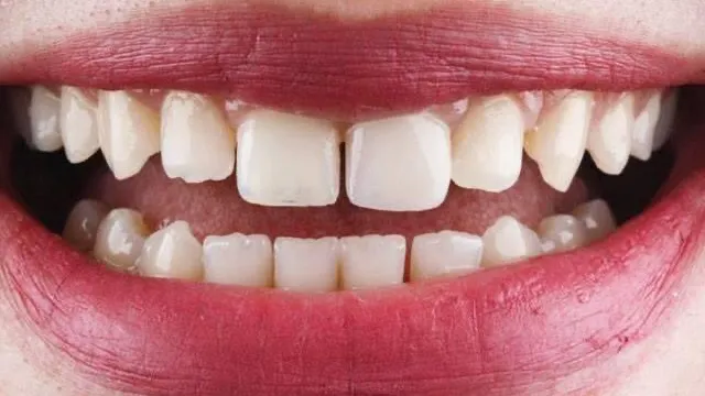 Dr.Ahmed Gouda Dental Care ((suzanna))