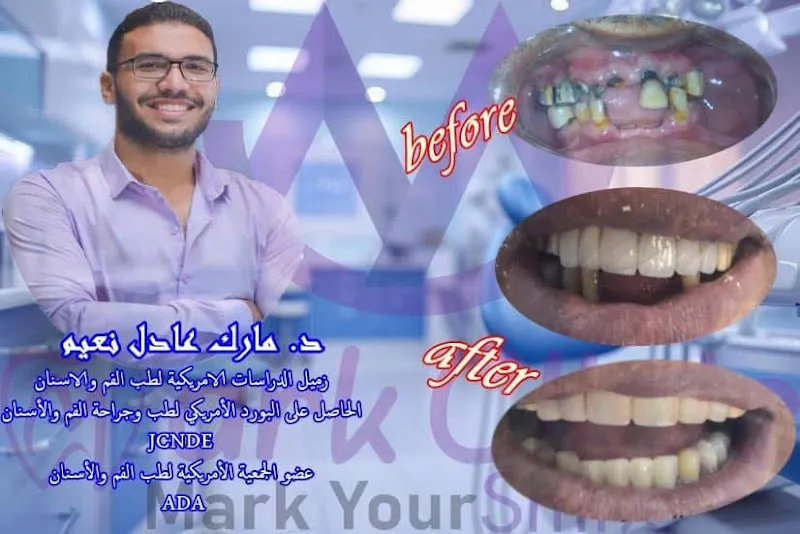 Mark clinic عيادة دكتور مارك عادل لجميع خدمات الاسنان