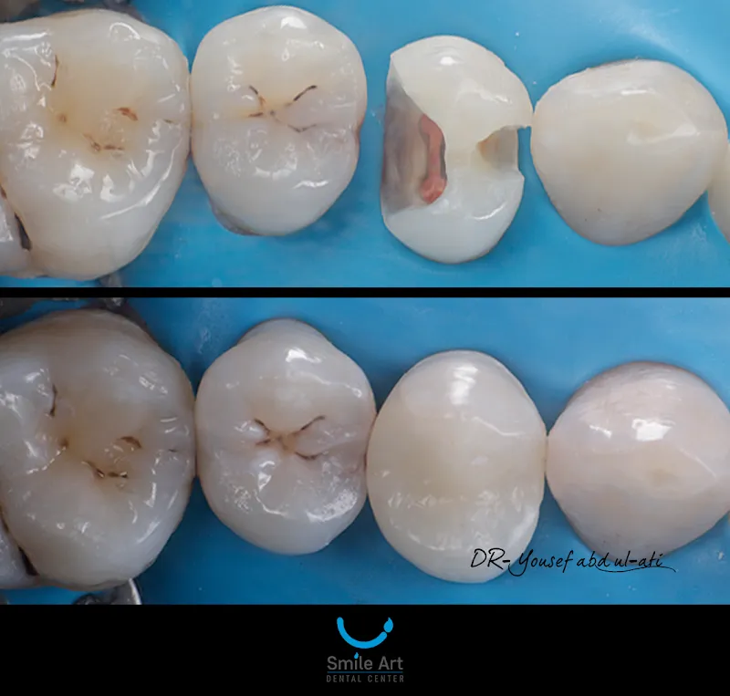 Smile Art Dental Center Dental And Maxillofacial Center
