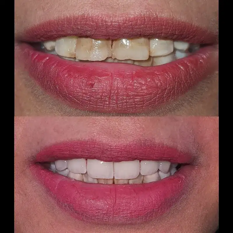 Dr. Ahmed Khalifa - Oral Surgeon