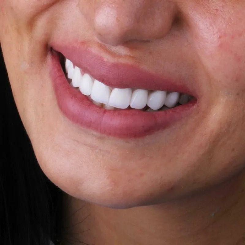 Dr. Osama Abuzeid Dental Aesthetics and Implant Center (Saudi Clinic)