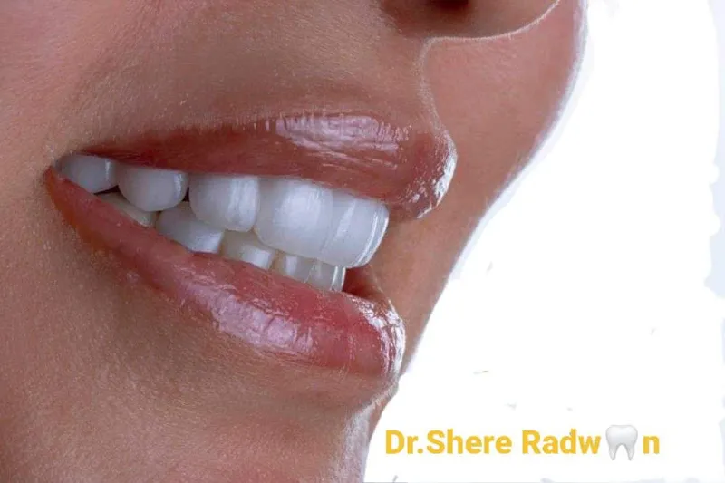 د/شيريهان أحمد رضوان استشاري علاج الجذور وتجميل الأسنان SHEREDENT SMILES SSEDC