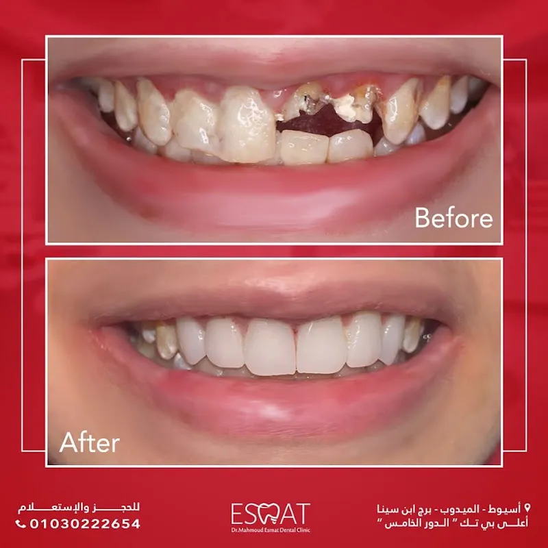 Esmat Dental Clinic عياده د محمود عصمت أخصائي الأسنان