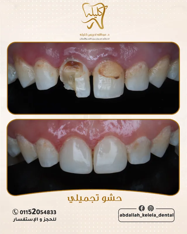 Dr. Abdullah Idris Kalila Dental Clinic - Al-Jadeed Street