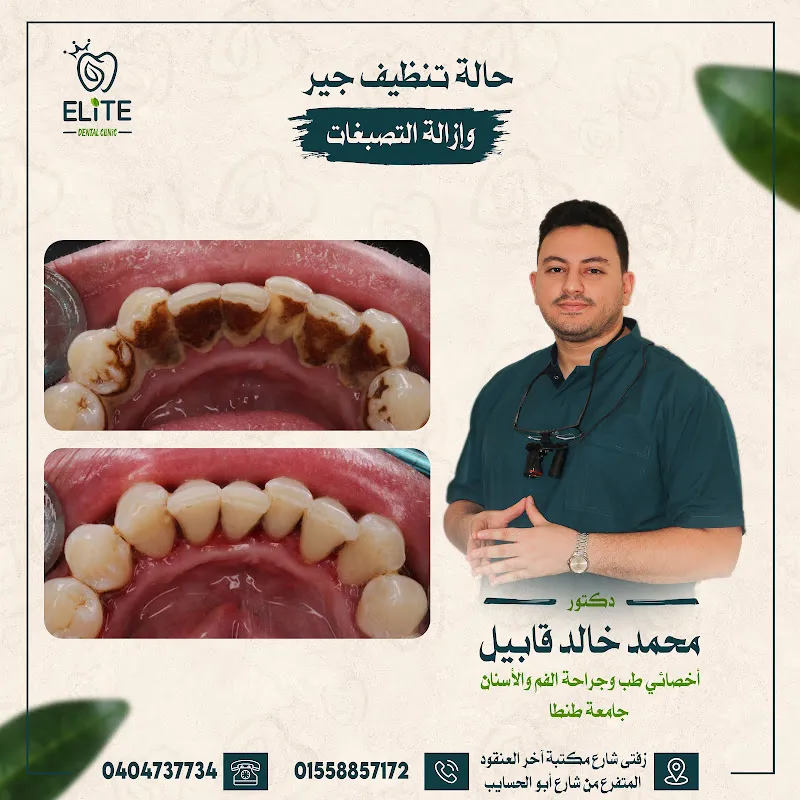 Elite Dental Clinic - لطب الفم والأسنان