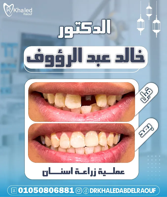 Dr. Khaled Abdelraouf, Dentist