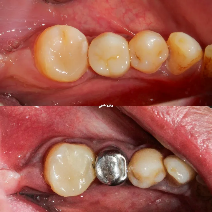 مركز كواليتي لطب الأسنان 🦷 Quality Dental clinic..د خالد الحنفي/د خلود عادل خليل
