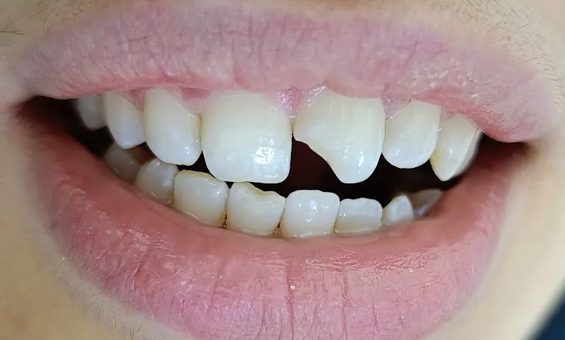 Dura Sharm Dental Clinic