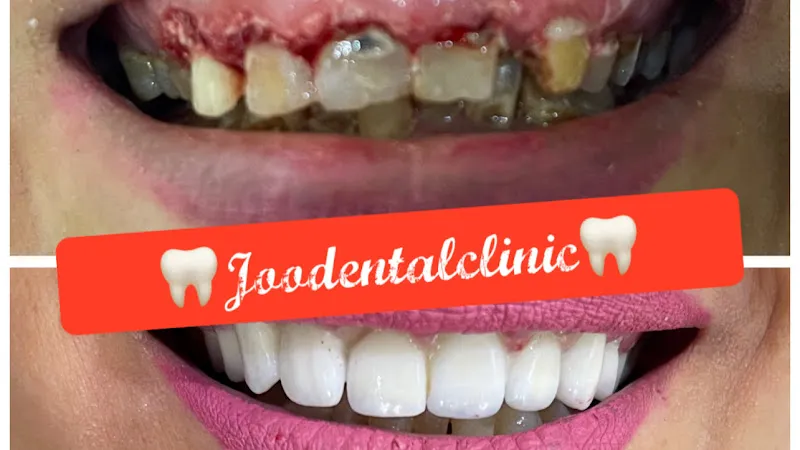 عيادة دكتور يوسف نصر الفيومى Joo dental clinic ️