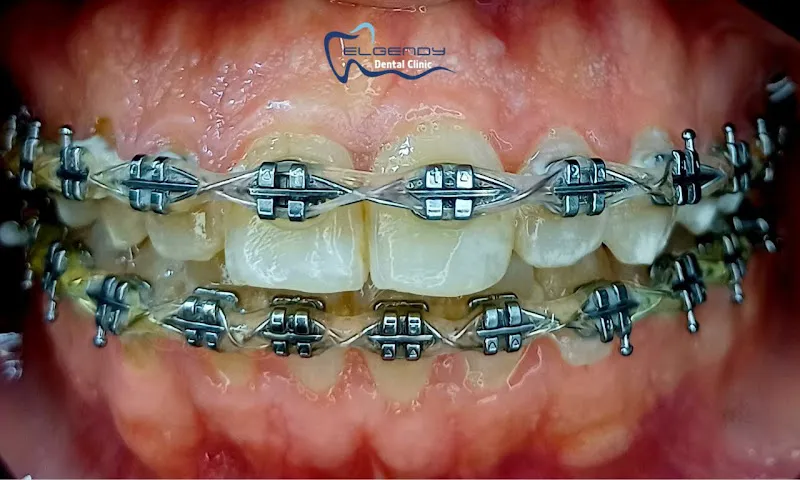 Dental Clinic Dr. Mohamed Taha El Guindy for Orthodontics and Dental Implants
