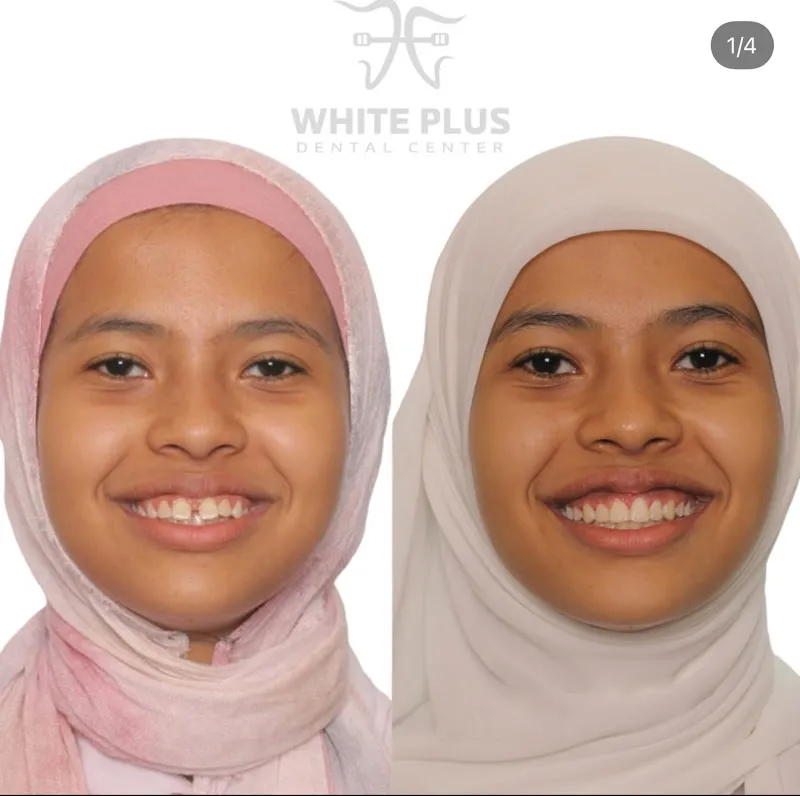 مستشفي النيل التخصصي