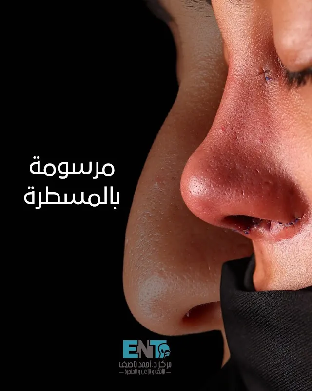 مركز مناظير وجراحات الأنف والأذن والحنجرة - فرع مصر الجديدة - ENT Clinic, Heliopolis Branch