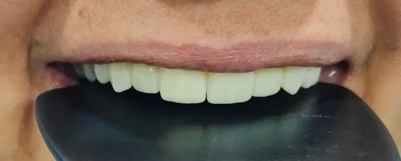 Dr/ Osama Abdrabo Dental Clinic