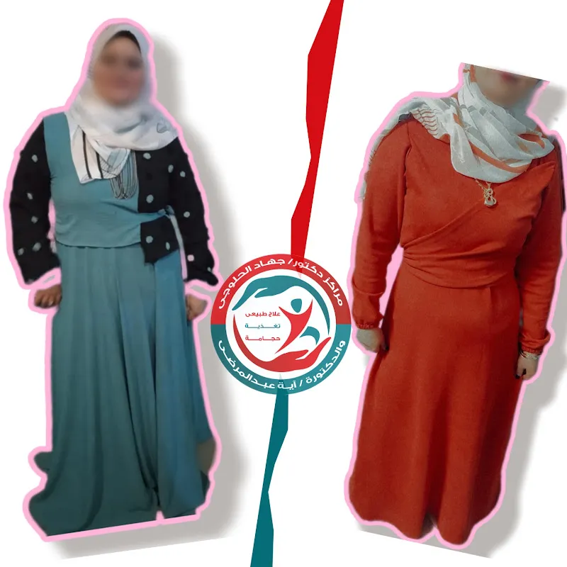 مراكز دكتور جهاد الحلوجي للتخسيس وتنسيق القوام