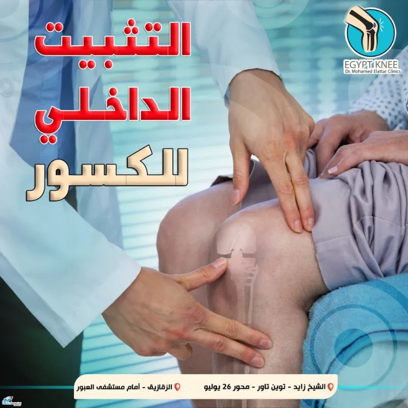 دكتور محمد العطار استشاري العظام عيادة الشيخ زايد