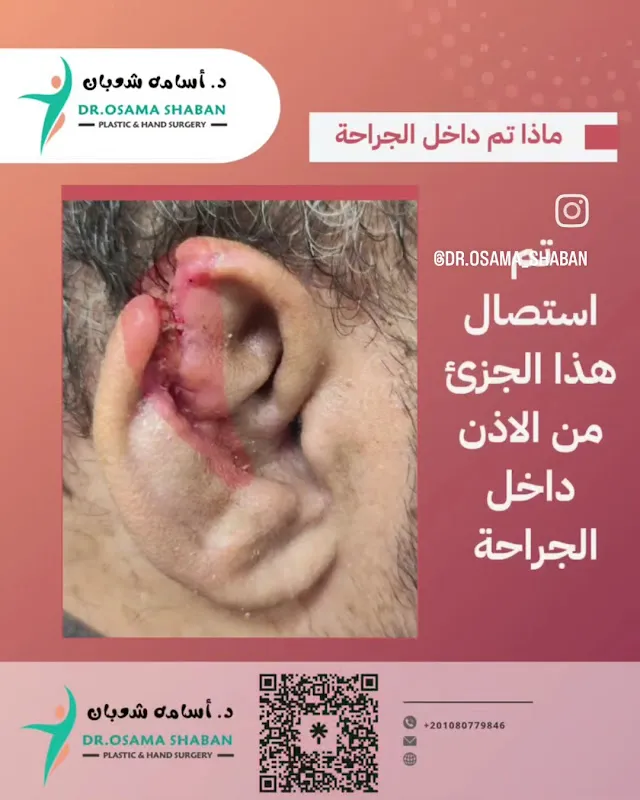 عيادة د. اسامه شعبان . اخصائي جراحة التجميل والحروق وتنسيق القوام