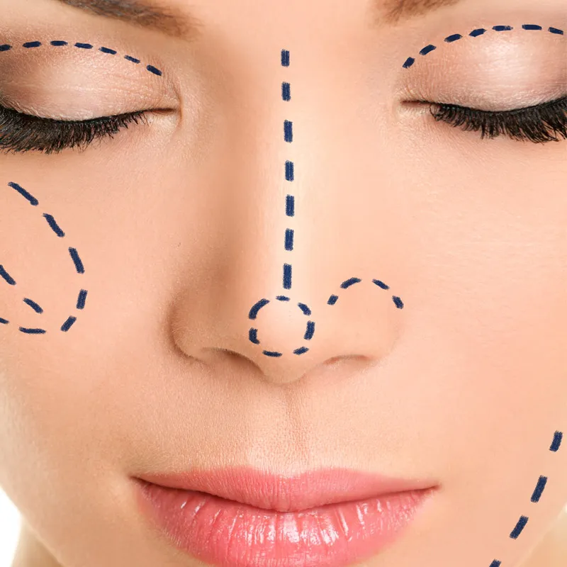 Alfayrouz clinic for plastic surgery doctor Ayman alfiky الفيروز كلينك جراحة التجميل تنسيق القوام جراحة اليد فيصل