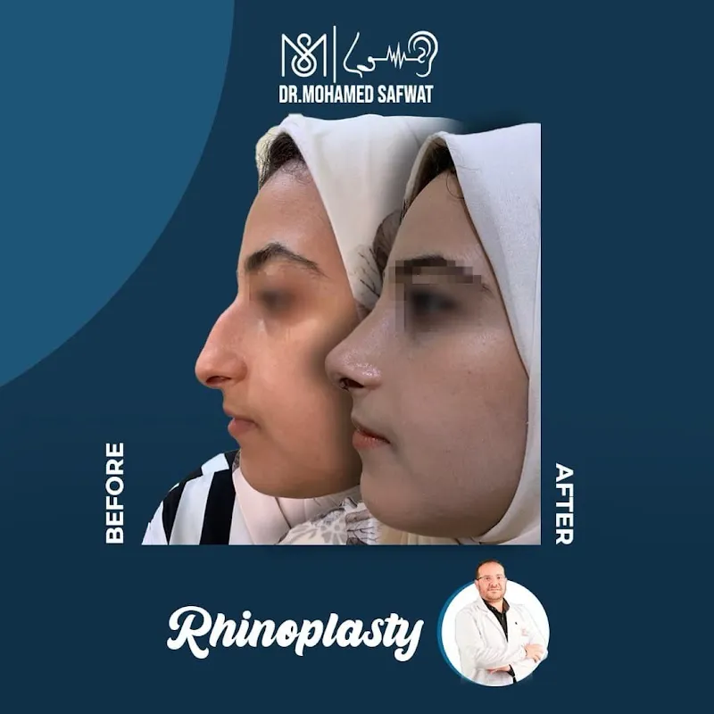 Dr. Mohamed Safwat Clinic, Consultant of Ear, Nose and Throat
