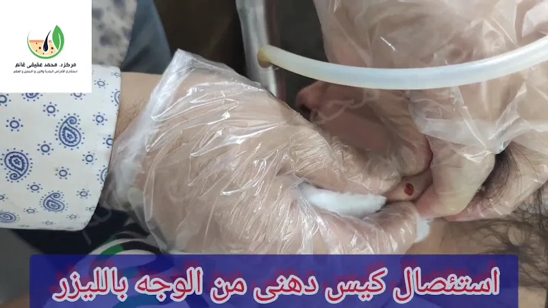 مركز ا.د / محمد عفيفي غانم استشارى الأمراض الجلدية والليزر والعقم